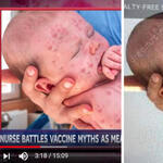 CNN and NBC Caught Faking Photo of Baby with Measles